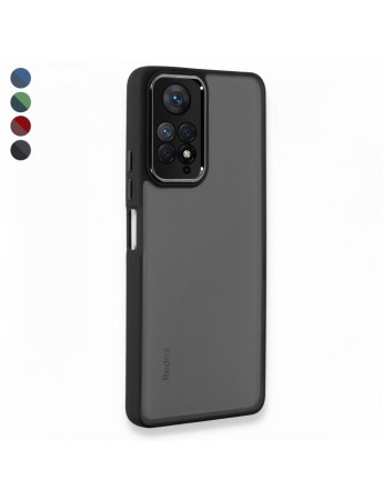 Xiaomi Redmi Note 11 / 11s Kılıf Freya Lazer Lens Kamera Çerçeveli Silikon Kapak