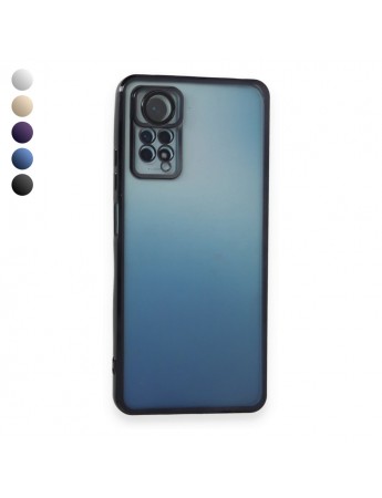 Xiaomi Redmi Note 11 / 11s Kılıf Razer Lens Çerçeveli Silikon Kapak