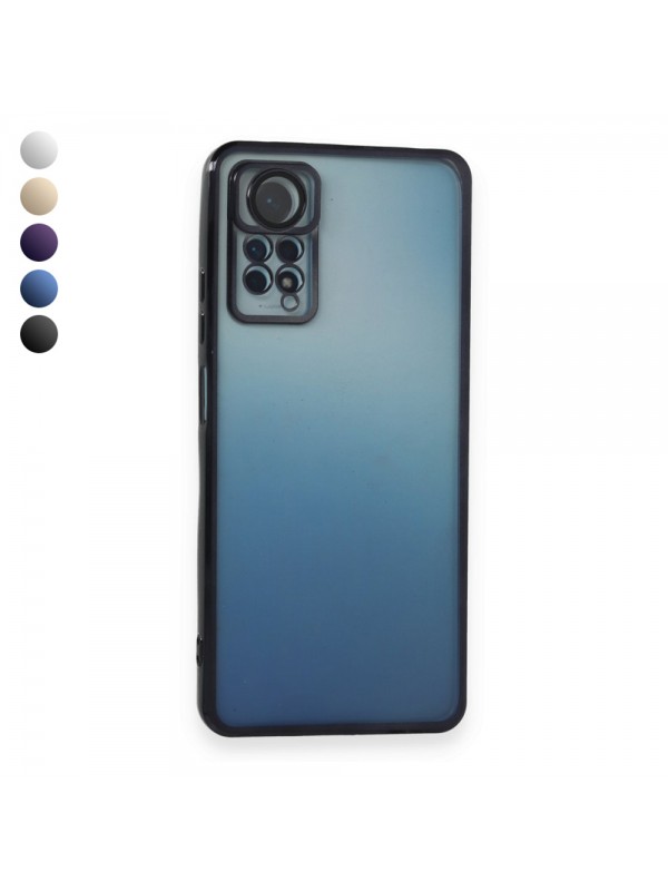 Xiaomi Redmi Note 11 / 11s Kılıf Razer Lens Çerçeveli Silikon Kapa…